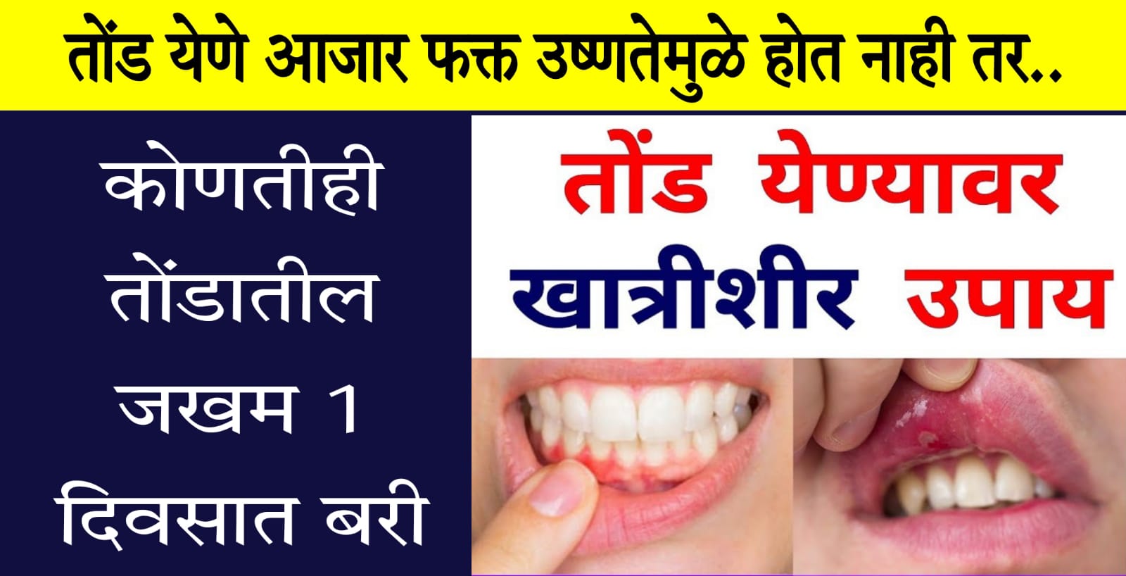 पुन्हा आयुष्यात कधीच तोंड येणार नाही.. कोणतीही तोंडातील ज’खम एका दिवसता बरी होईल.. एकदा करून पहाच..